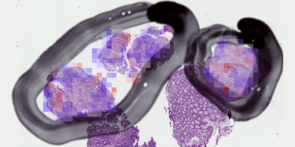 Exploring the potential of AI-enabled medical imaging