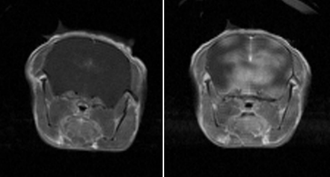 Brain Drug Delivery