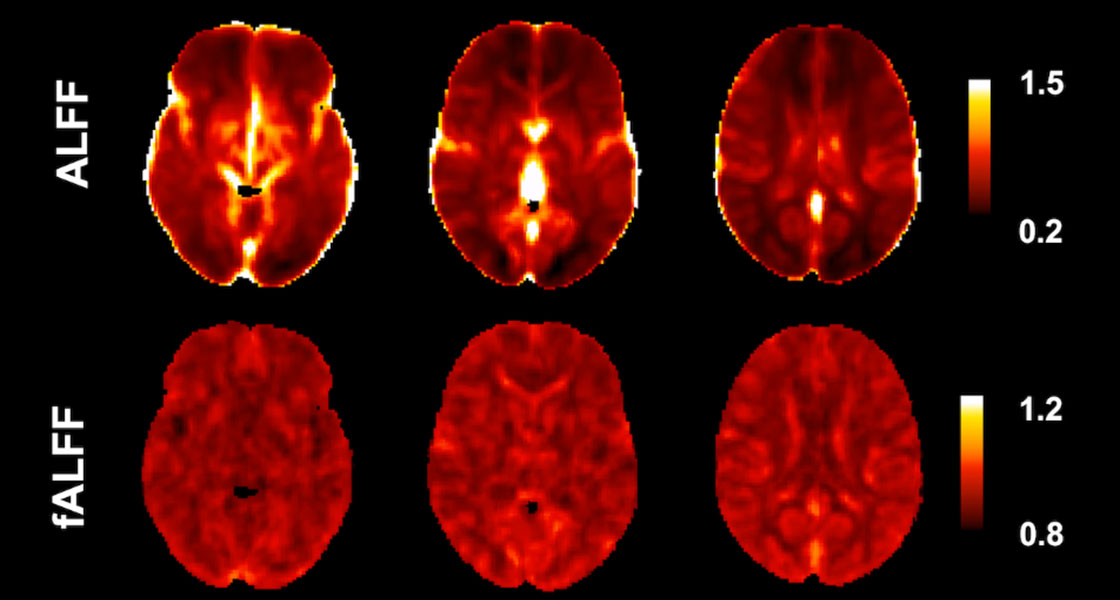 Neurovascular Assessment