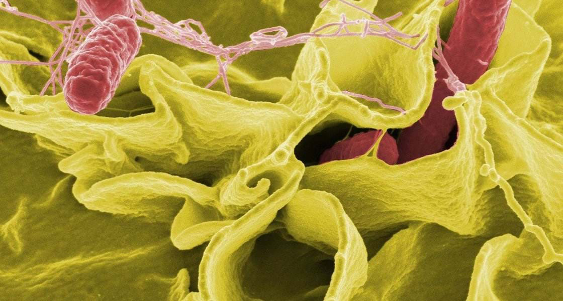 Complex Disease